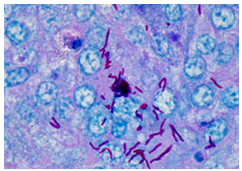 Hiểu biết về bệnh lao (Tuberculosis) ở bò và cách phòng chống